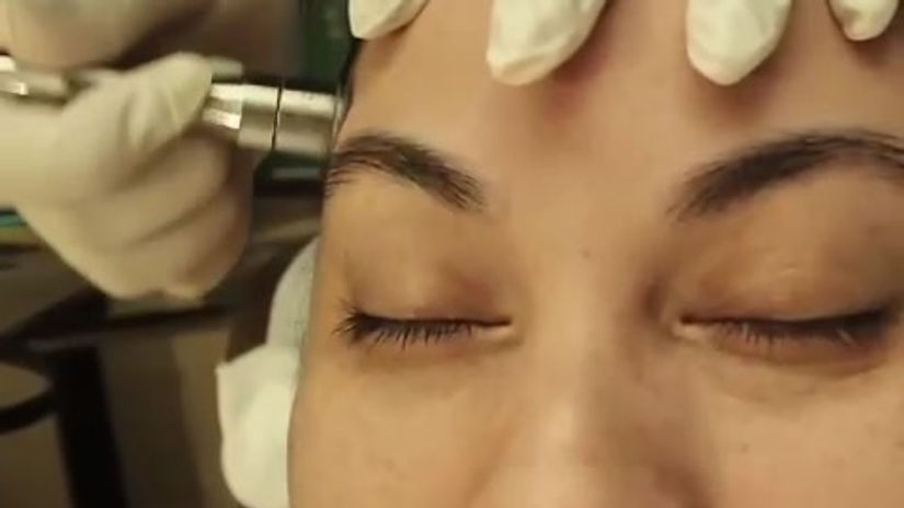 Tratamiento Detox Facial